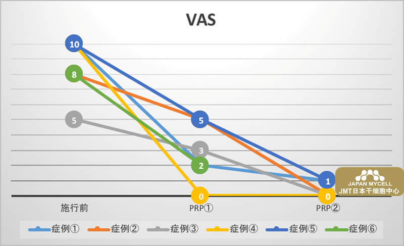 JMT日本干细胞-什么是PRP（富血小板血浆）疗法？③