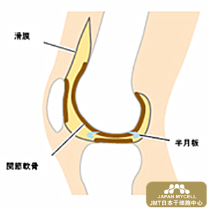 JMT日本干细胞——世界首次挑战半月板的再生医疗—日本850万膝痛患者的福音！（前篇）②