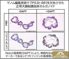 JMT日本干细胞——分析阐明胃肠道神经内分泌癌症的病理学-揭开世界第一难治癌症的真相，有望促进药物开发②