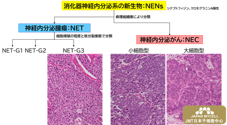 JMT日本干细胞——分析阐明胃肠道神经内分泌癌症的病理学-揭开世界第一难治癌症的真相，有望促进药物开发①