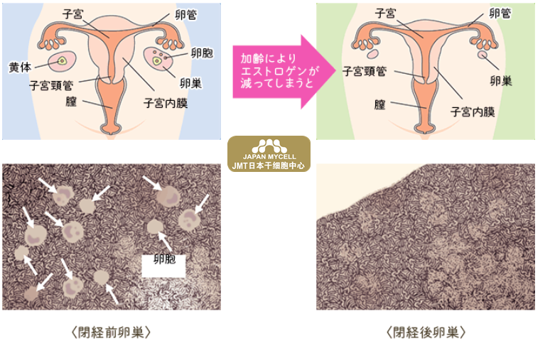JMT日本干细胞中心-更年期身体的变化及日本经血干细胞改善更年期