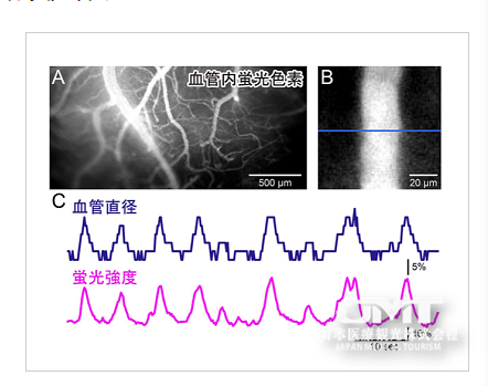 JMT日本医疗—视觉刺激对大脑进行血管训练可能导致大脑功能的扩展 