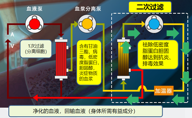 血液净化cbp图片